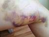 ������� �� ����������� ��� ����������
��������: ImageUploadedByTapatalk1401621034.003767.jpg
����������: 130
������:	16,0 ��
ID:	108122