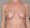     
: ImageUploadedByTapatalk1403694275.708789.jpg
: 398
:	63,3 
ID:	109537