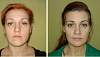     
: ImageUploadedByPlastic-Surgeon.Ru1457614372.178862.jpg
: 183
:	16,8 
ID:	155119