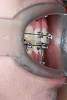 ������� �� ����������� ��� ����������
��������: ImageUploadedByPlastic-Surgeon.Ru1457615710.265954.jpg
����������: 246
������:	11,1 ��
ID:	155123