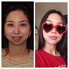 ������� �� ����������� ��� ����������
��������: ImageUploadedByPlastic-Surgeon.Ru1457615770.419963.jpg
����������: 342
������:	8,7 ��
ID:	155125