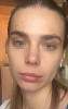     
: ImageUploadedByPlastic-Surgeon.Ru1457962532.268532.jpg
: 472
:	10,7 
ID:	155533