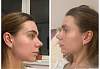     
: ImageUploadedByPlastic-Surgeon.Ru1457989756.328153.jpg
: 437
:	12,0 
ID:	155579