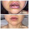     
: bffe470e.jpg
: 389
:	36,3 
ID:	163217