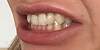     
: 822de9db.jpg
: 344
:	19,0 
ID:	214881