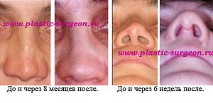     
: 0b27fb54.jpg
: 57
:	49,8 
ID:	231019