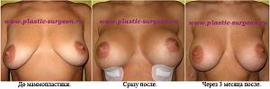    
: b267a2ba.jpg
: 79
:	50,3 
ID:	232052