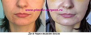     
: 884efaf1.jpg
: 188
:	51,8 
ID:	234596