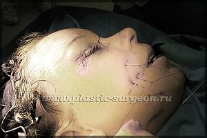     
: c8eec8c3.jpg
: 95
:	56,0 
ID:	234828