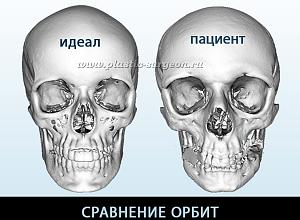     
: a498645f.jpg
: 253
:	85,8 
ID:	235198