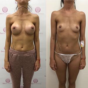     
: ae6171d5.jpg
: 141
:	56,2 
ID:	235817