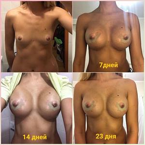 ������� �� ����������� ��� ����������
��������: b9b69100.jpg
����������: 93
������:	126,2 ��
ID:	243689