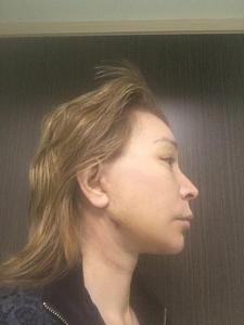     
: aaacec65.jpg
: 139
:	20,6 
ID:	243828