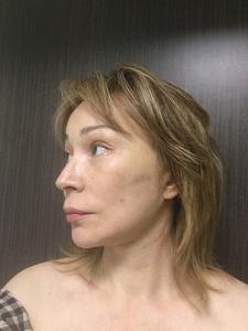     
: ec5147ed.jpg
: 190
:	24,8 
ID:	245495