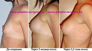     
: 2506c928.jpg
: 78
:	63,2 
ID:	245715