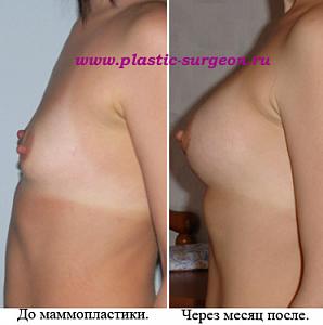     
: 83d52965.jpg
: 74
:	48,2 
ID:	245716