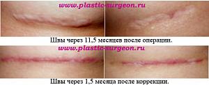     
: 6f1d5875.jpg
: 46
:	52,9 
ID:	245798