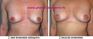     
: 8319d9ff.jpg
: 81
:	52,5 
ID:	247012