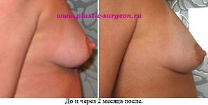     
: b41e768f.jpg
: 74
:	50,3 
ID:	247021