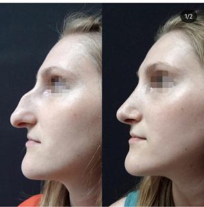 ������� �� ����������� ��� ����������
��������: 60dbf572.jpg
����������: 65
������:	55,4 ��
ID:	247278
