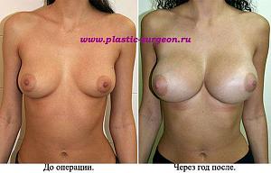     
: eceb05a4.jpg
: 150
:	62,4 
ID:	247535