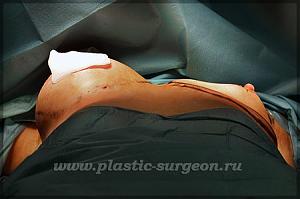    
: fb3dcb6a.jpg
: 117
:	45,7 
ID:	247841