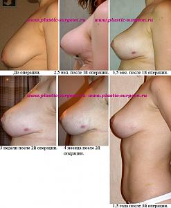     
: 2a2988dc.jpg
: 146
:	103,0 
ID:	248168