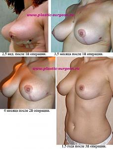     
: 80738f09.jpg
: 140
:	87,0 
ID:	248169
