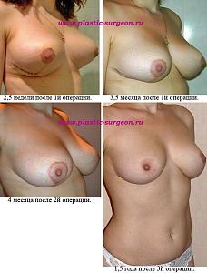     
: 1f668216.jpg
: 168
:	87,2 
ID:	248170