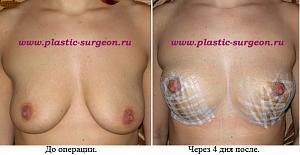     
: b7c74095.jpg
: 115
:	86,2 
ID:	248179