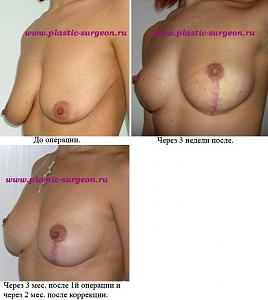     
: 212040ed.jpg
: 98
:	63,8 
ID:	248183