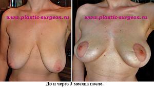     
: 8d341cf9.jpg
: 174
:	63,9 
ID:	248196