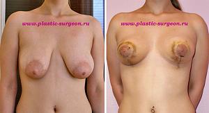     
: 8d9bde5a.jpg
: 150
:	74,9 
ID:	248204