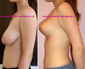     
: 90614c4b.jpg
: 97
:	76,3 
ID:	248208