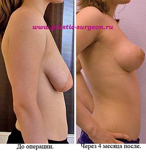     
: a94e9297.jpg
: 99
:	91,6 
ID:	248213