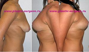    
: 596470da.jpg
: 128
:	82,8 
ID:	248304