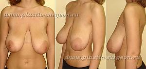     
: c8ea20f9.jpg
: 120
:	59,4 
ID:	248325