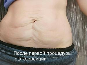     
: 260647b6.jpg
: 109
:	96,2 
ID:	248432