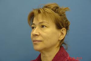     
: 6a8d1516.jpg
: 86
:	187,3 
ID:	250310