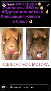 ������� �� ����������� ��� ����������
��������: 6594edf8.jpg
����������: 149
������:	44,1 ��
ID:	251266