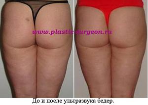     
: ae0fbadc.jpg
: 60
:	44,3 
ID:	251534