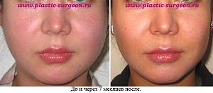     
: 57aabd7b.jpg
: 64
:	56,8 
ID:	251902