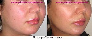     
: bc7b9fb4.jpg
: 61
:	54,3 
ID:	251903