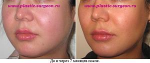     
: fad8be7e.jpg
: 59
:	53,7 
ID:	251904