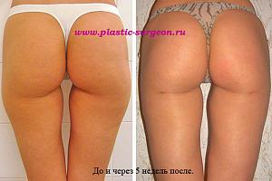     
: cba3e44f.jpg
: 81
:	72,3 
ID:	251964