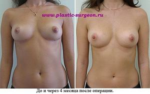     
: fc7e35e4.jpg
: 70
:	52,0 
ID:	251987