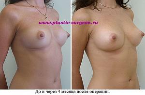     
: c55b02f3.jpg
: 64
:	50,1 
ID:	251988