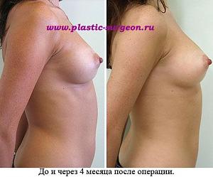     
: 43314c25.jpg
: 60
:	50,3 
ID:	251990