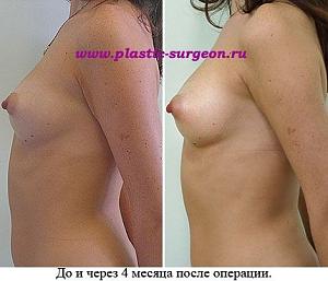     
: dc2c5f9a.jpg
: 60
:	51,2 
ID:	251991