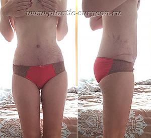     
: a2793d28.jpg
: 96
:	59,2 
ID:	252271